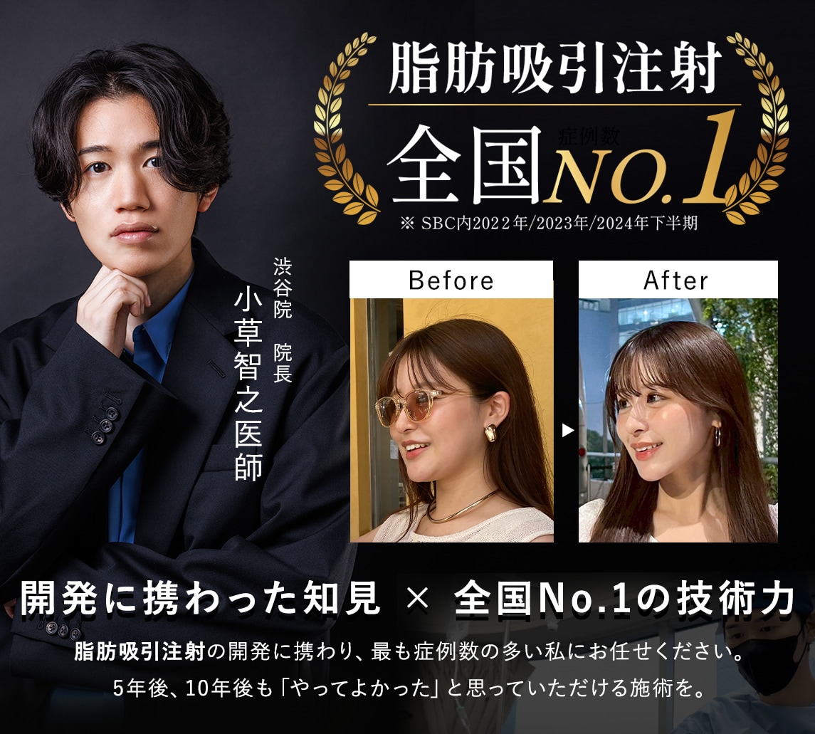 【2026年最新版】脂肪吸引注射が上手い医者は?「失敗したくない」人が渋谷院・小草医師を選ぶ理由