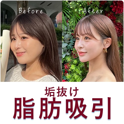 理想のフェイスライン