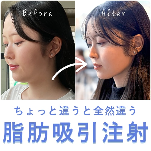 ちょっと違うと全然違うこの変化