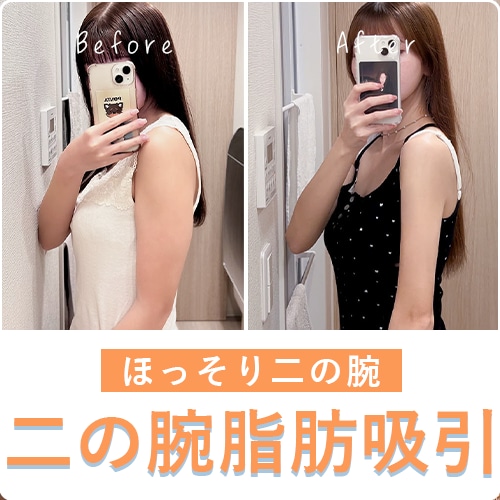 ダイエットで難しい二の腕もほっそり