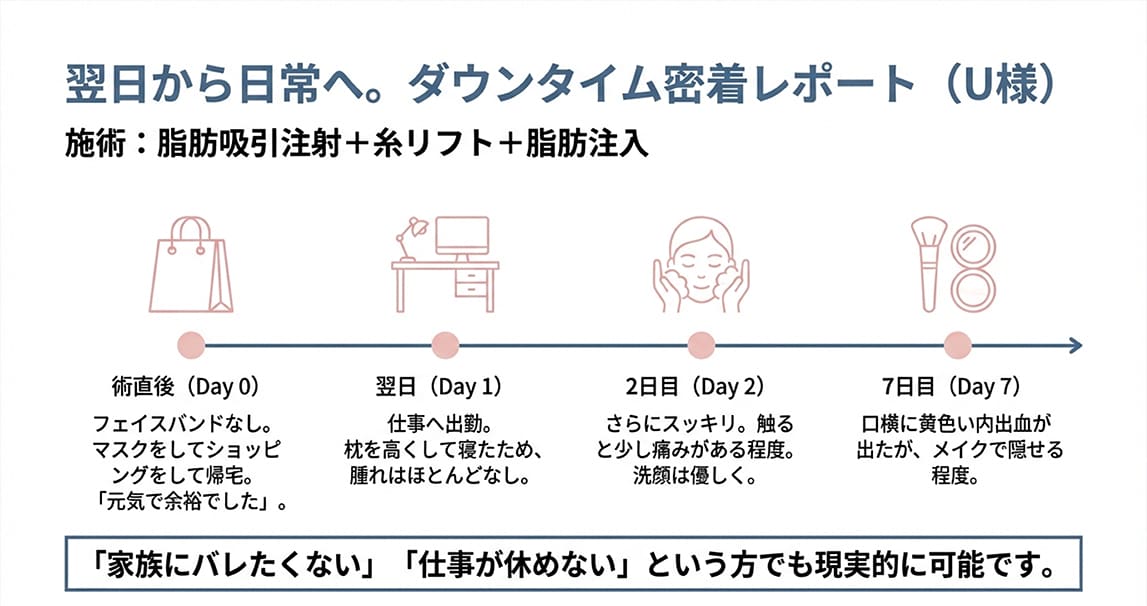 固定バンド不要でバレない！