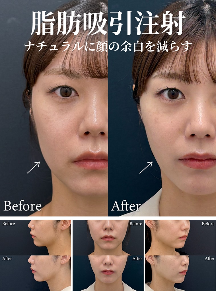 SNSの「奇跡の一枚」に騙されないで！ここをチェックしよう