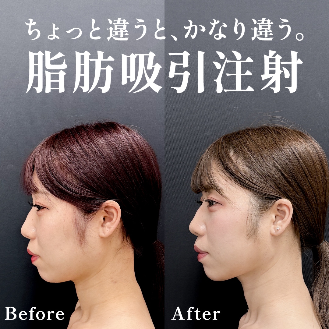 29歳モニター様