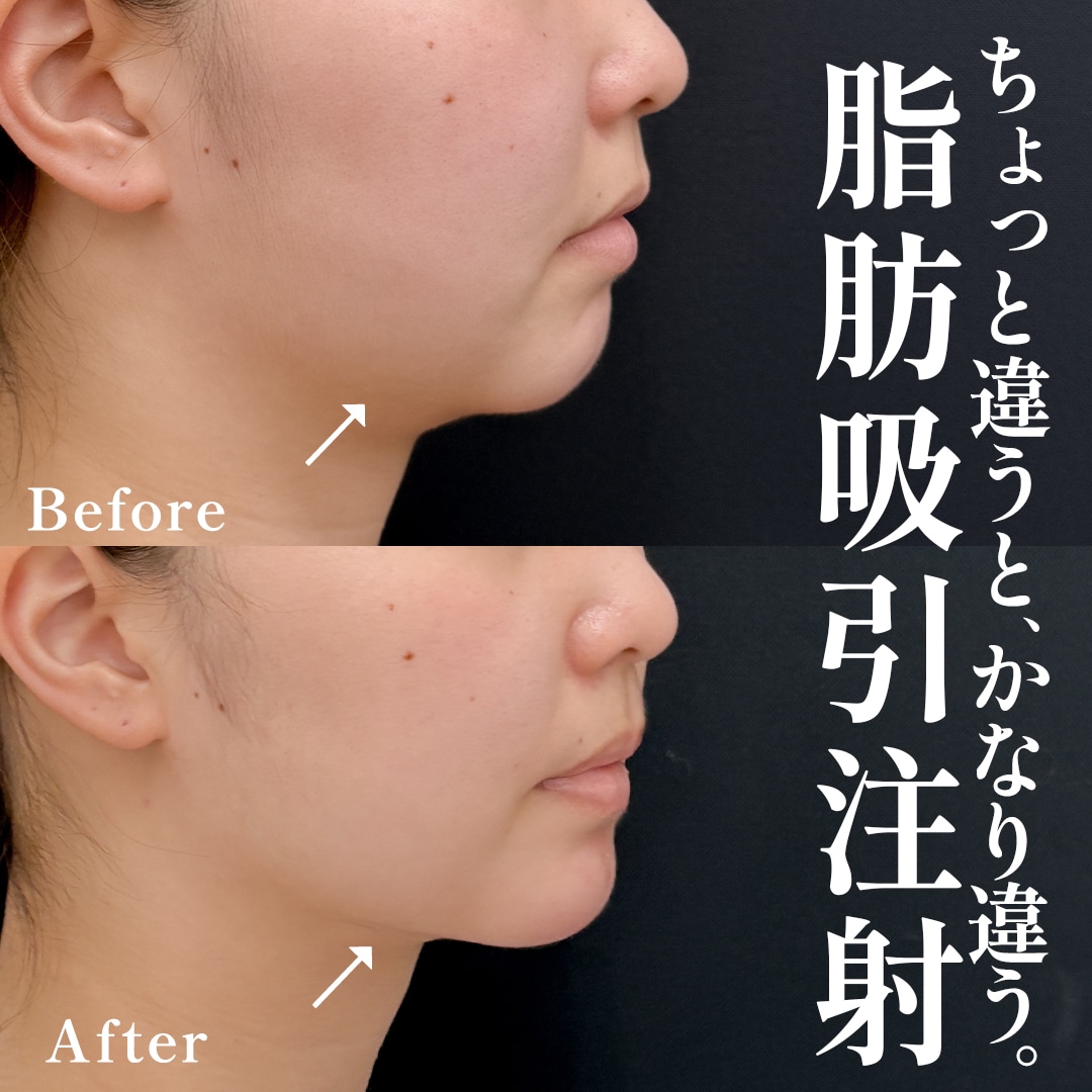 20代女性のモニター様