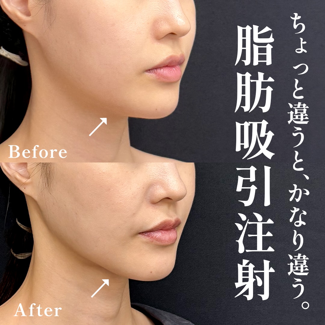 30代女性のモニター様