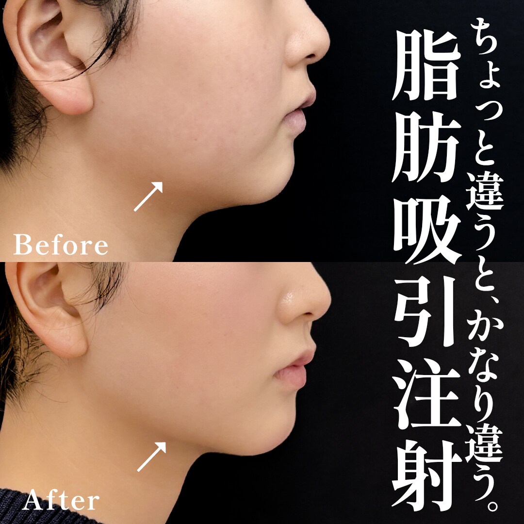 20代女性のモニター様