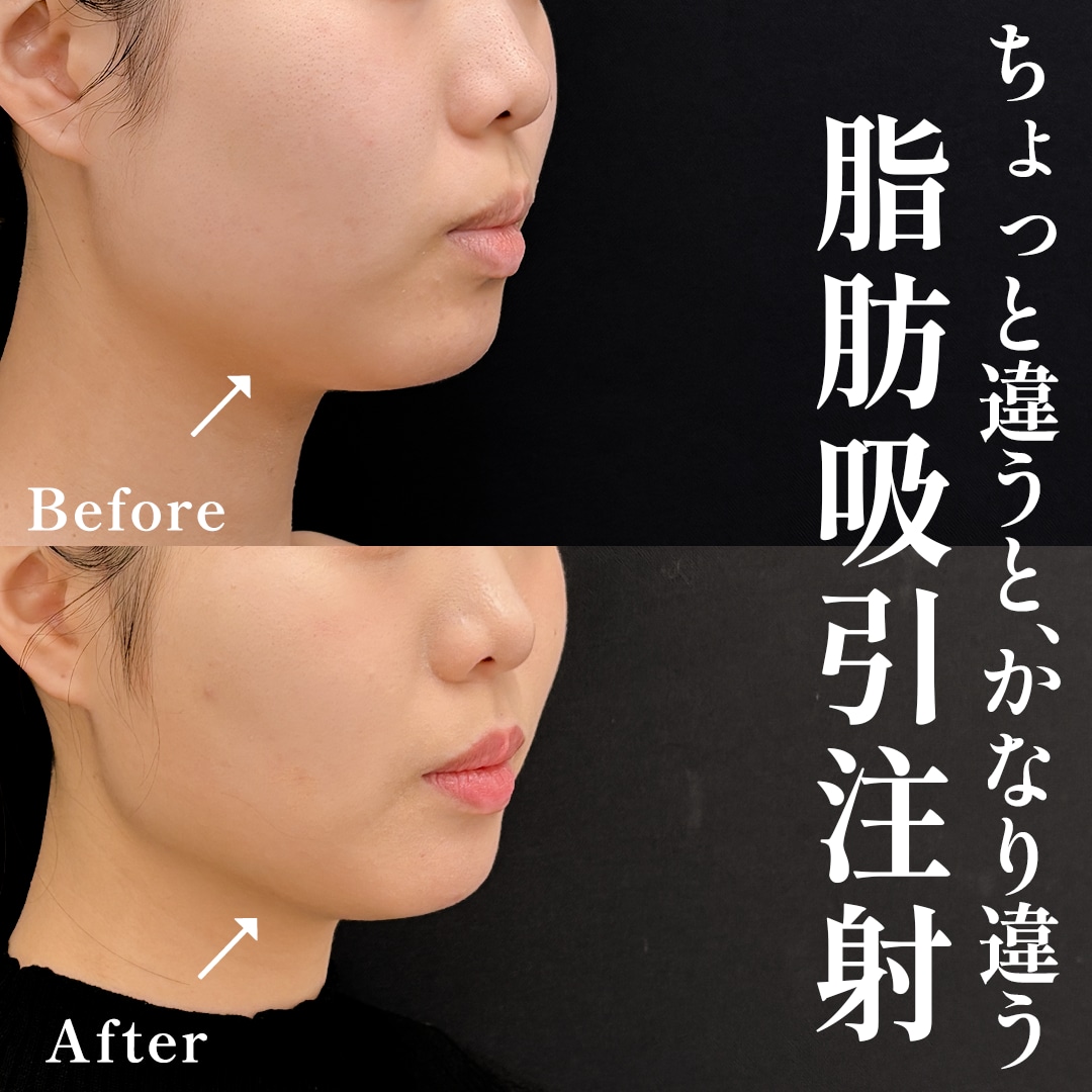 30代女性のモニター様