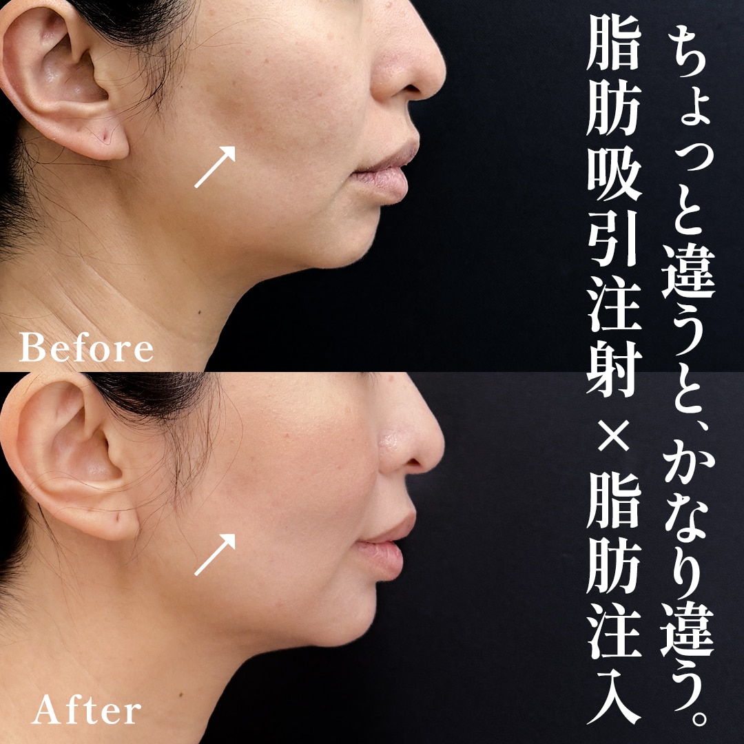 30代女性のモニター様