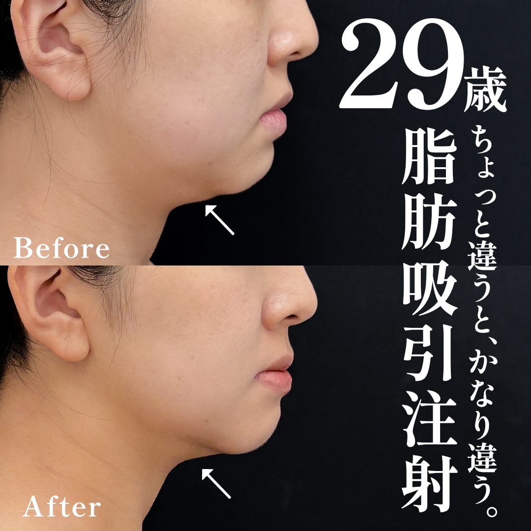 20代女性のモニター様