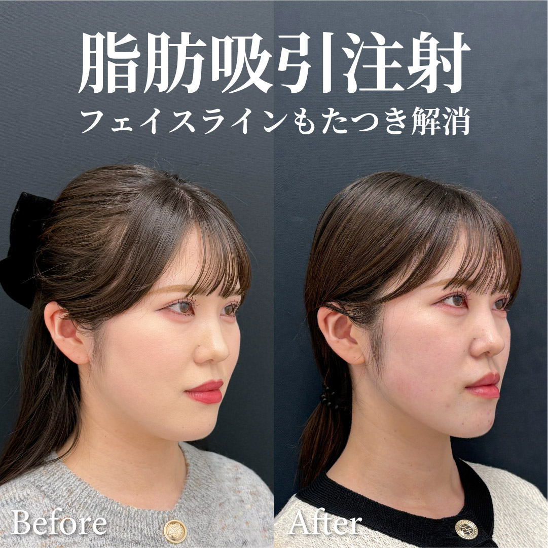 25歳女性のモニター様