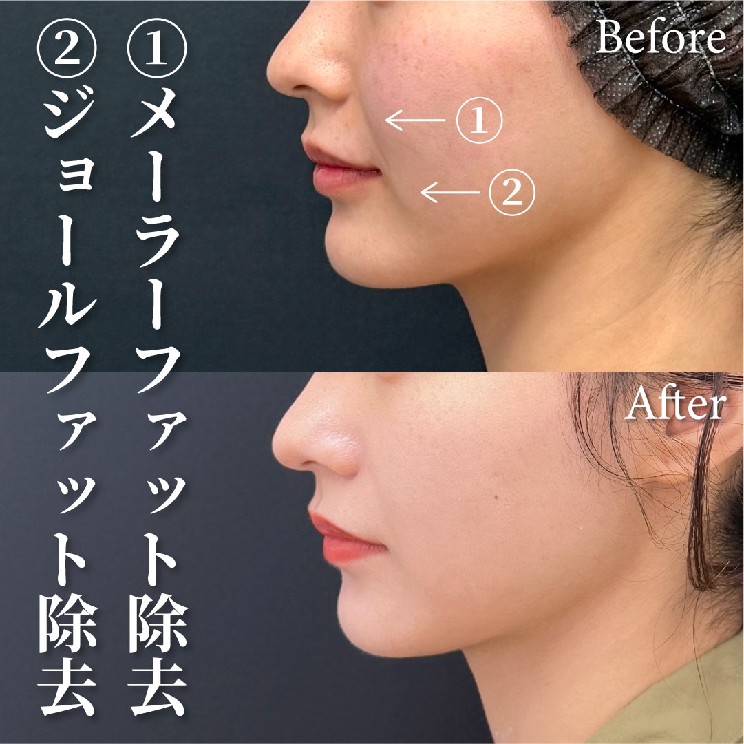 20代女性のモニター様