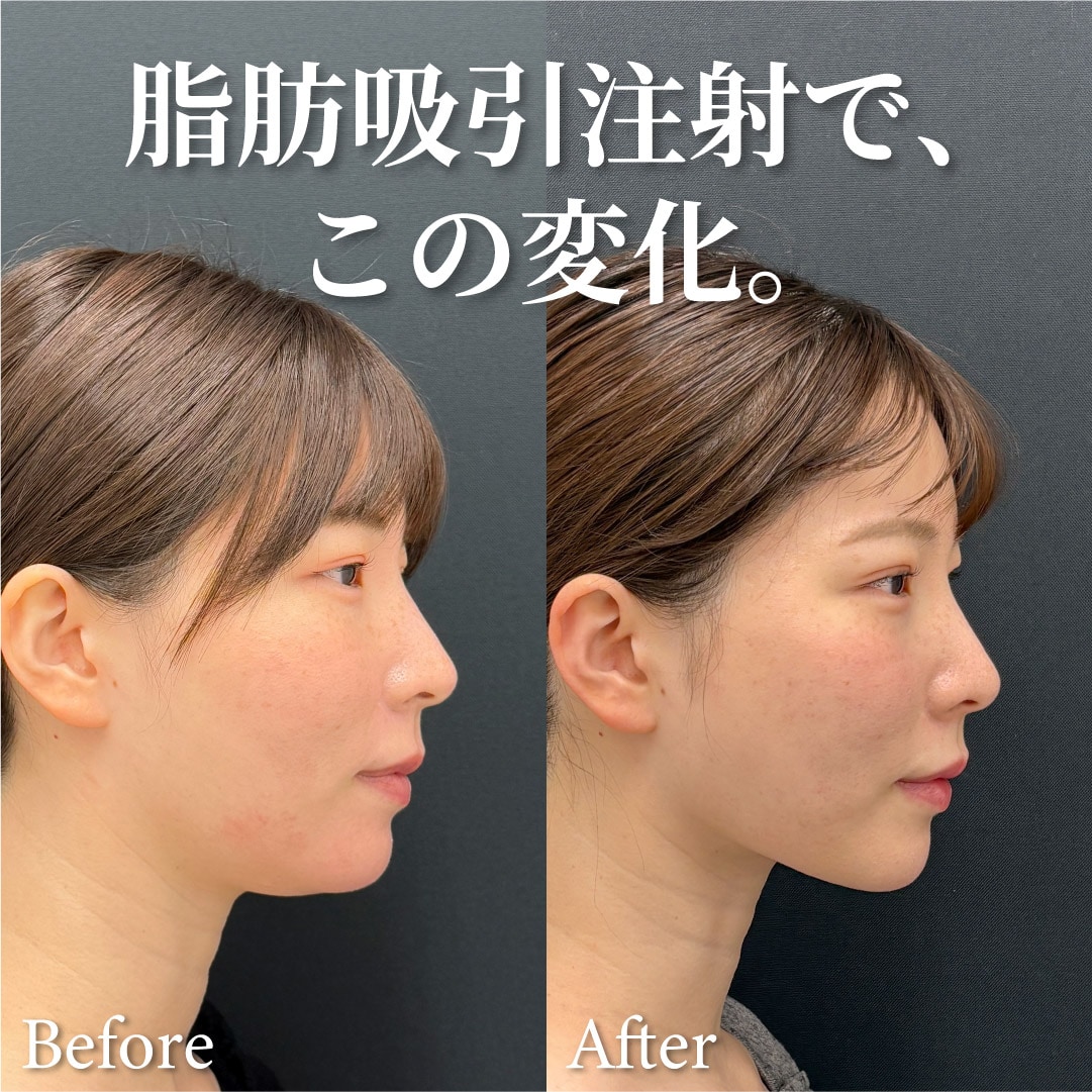 20代女性のモニター様