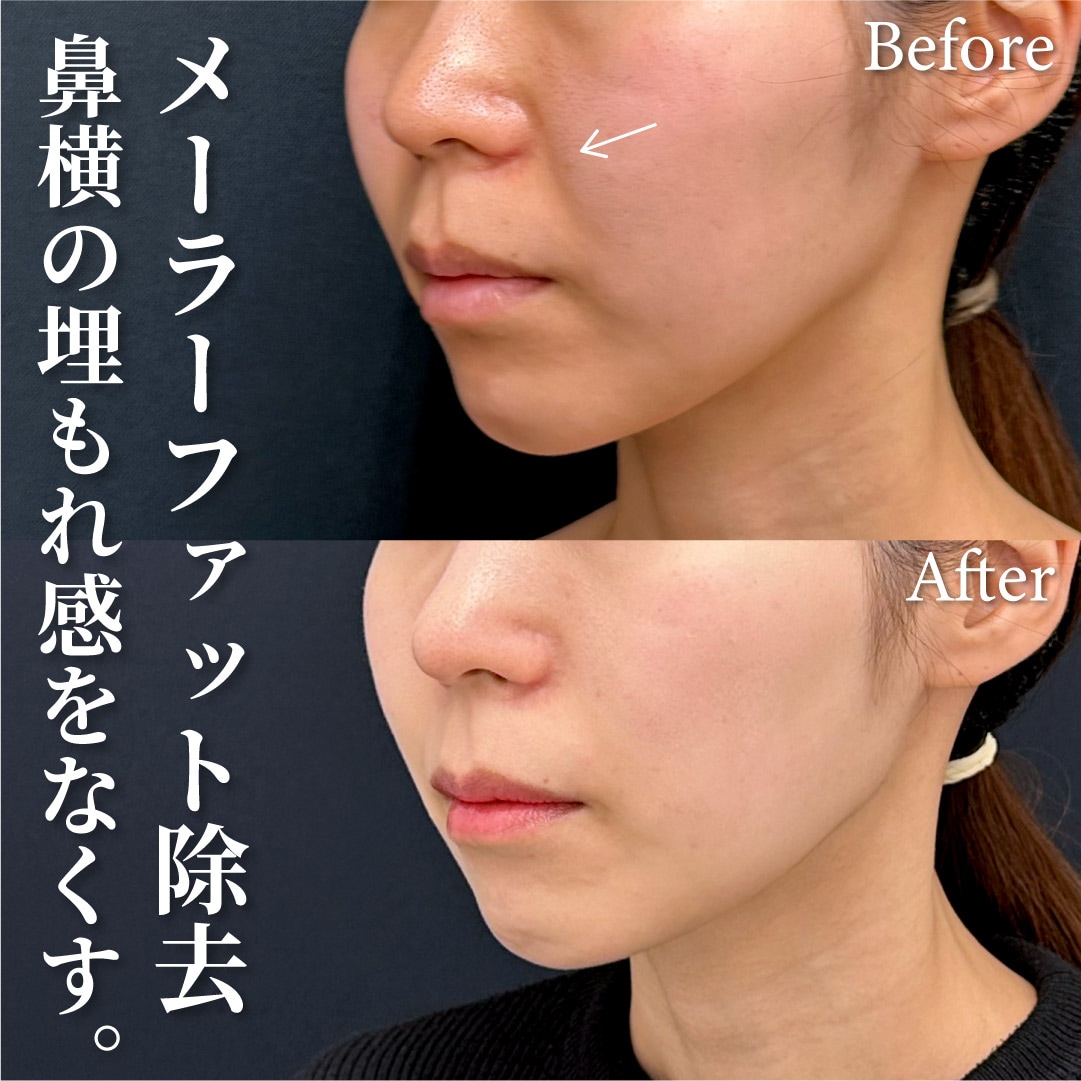 30代女性のモニター様