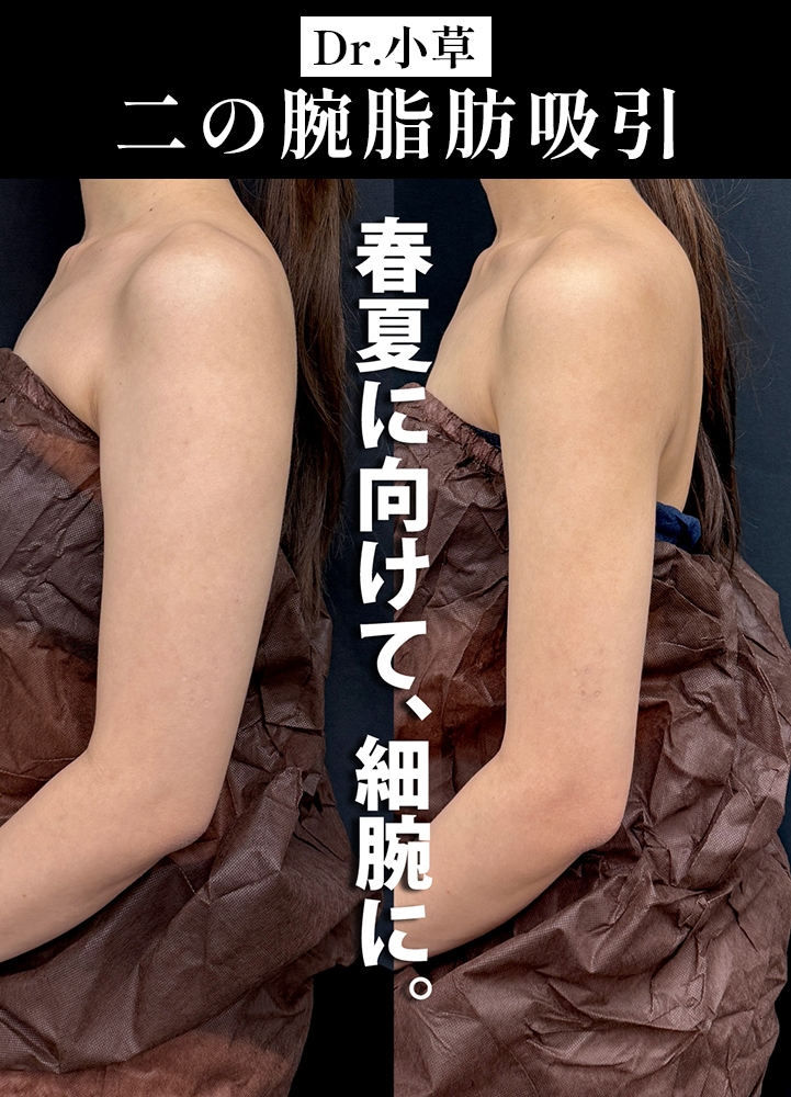 29歳のモニター様