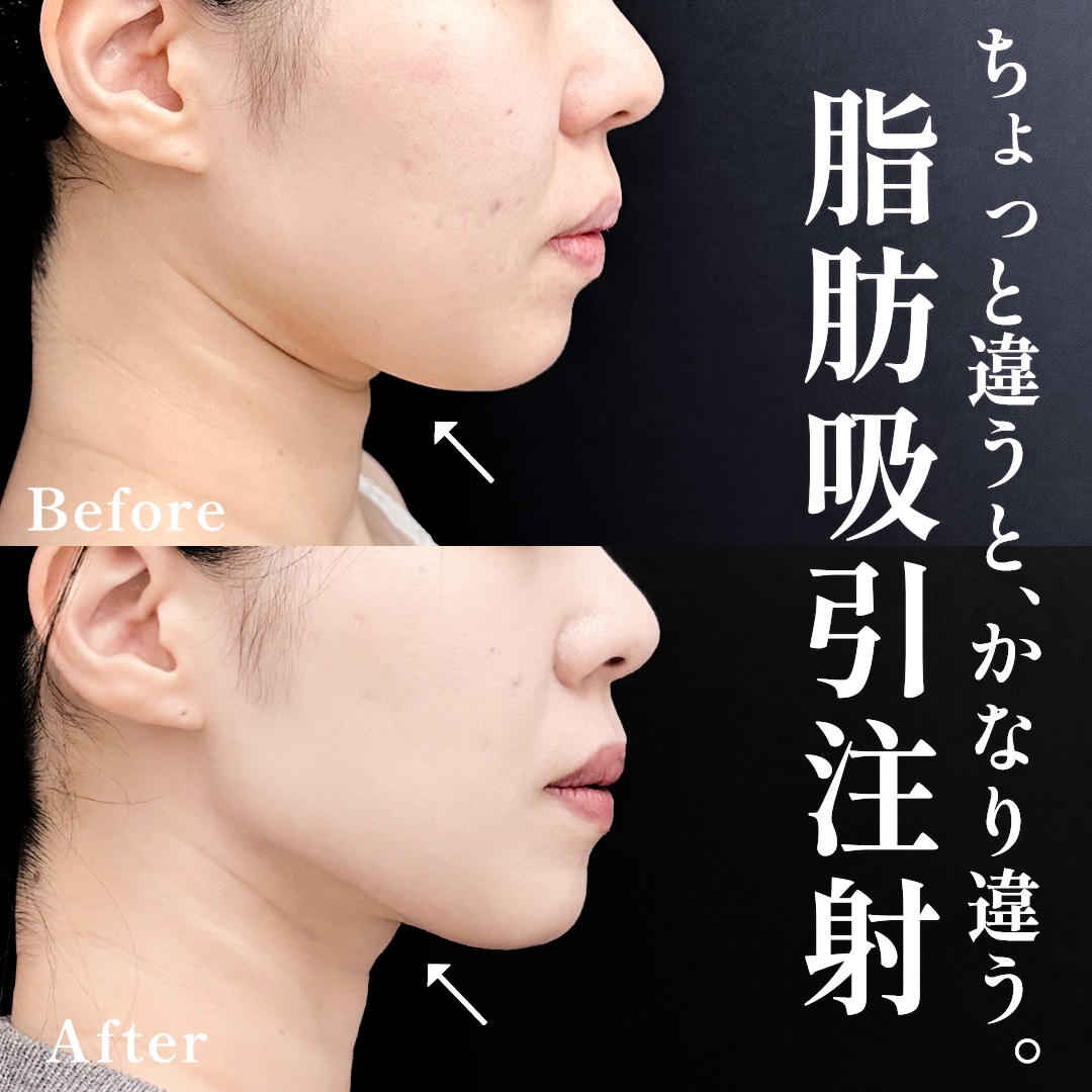 20代女性のモニター様