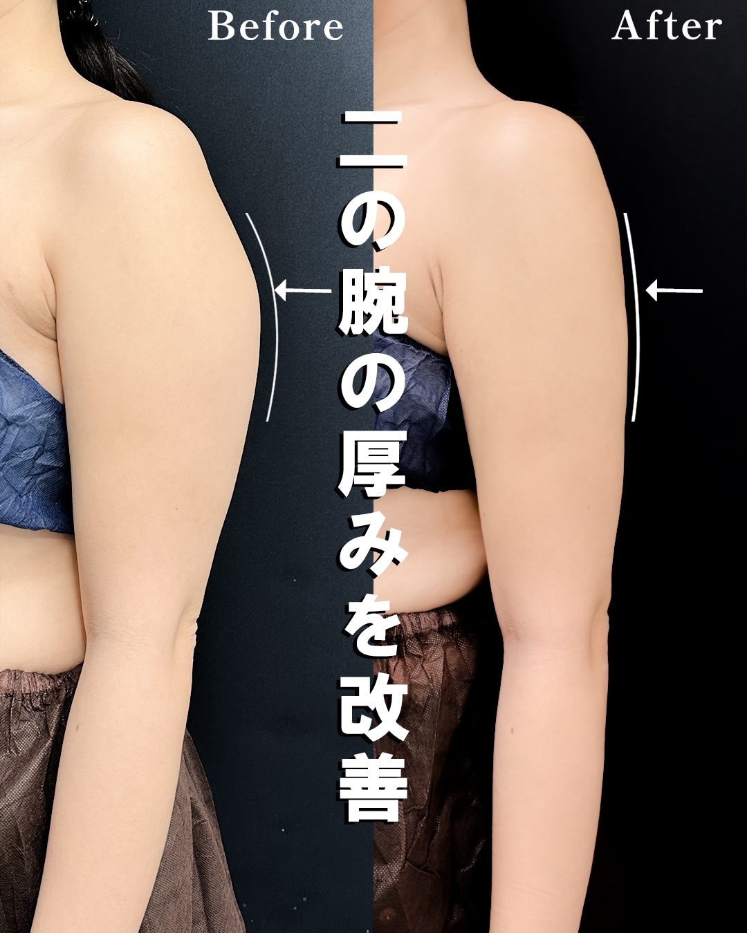 ３０代のモニター様