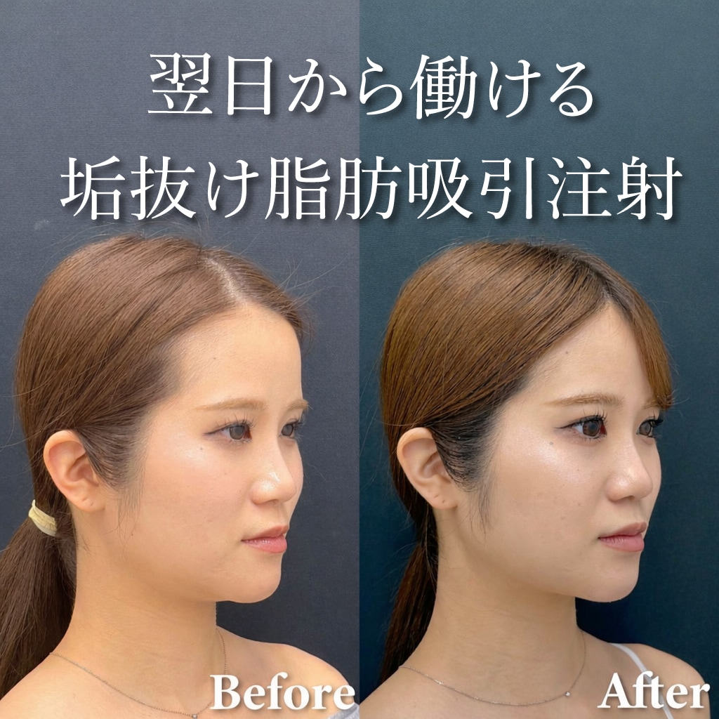 20代女性のモニター様