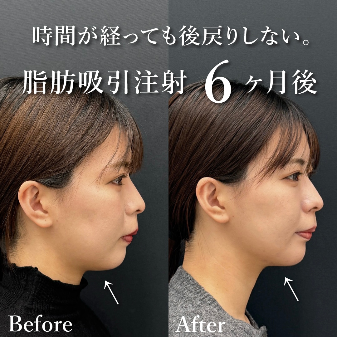 20代女性のモニター様