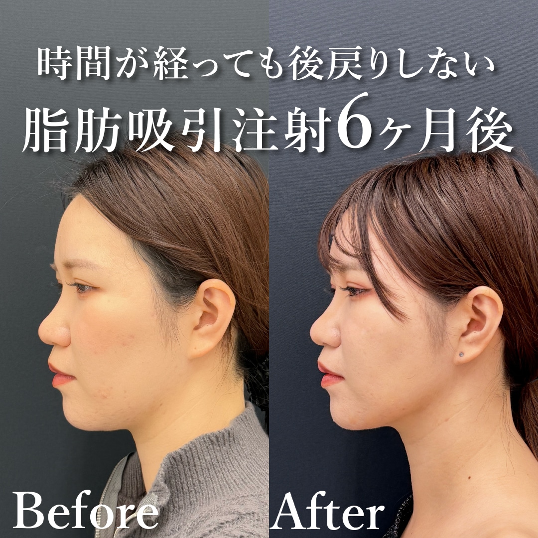 20代女性のモニター様