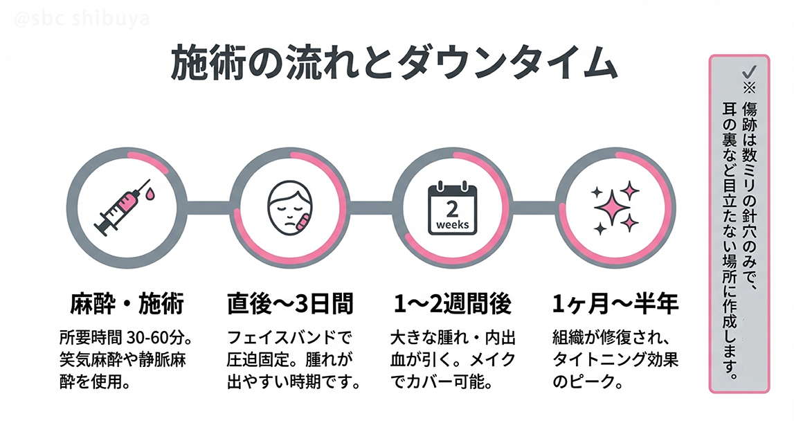 最小限のダウンタイムで、最大限の効果を