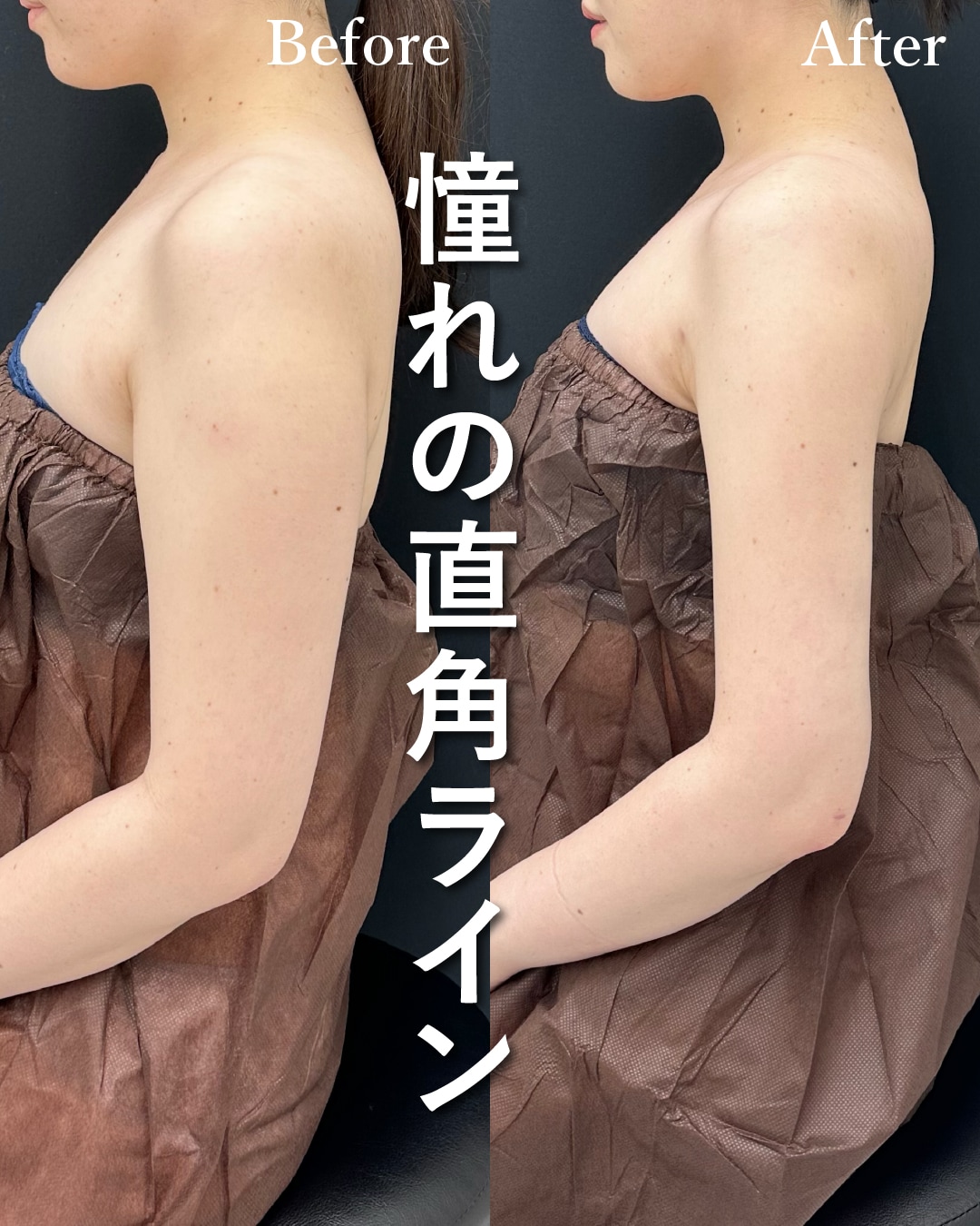 20代のモニター様