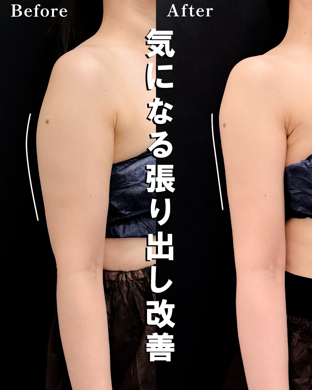 40代のモニター様