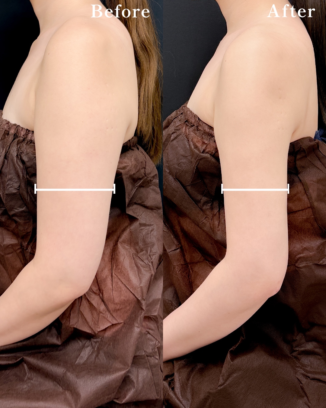 20代のモニター様