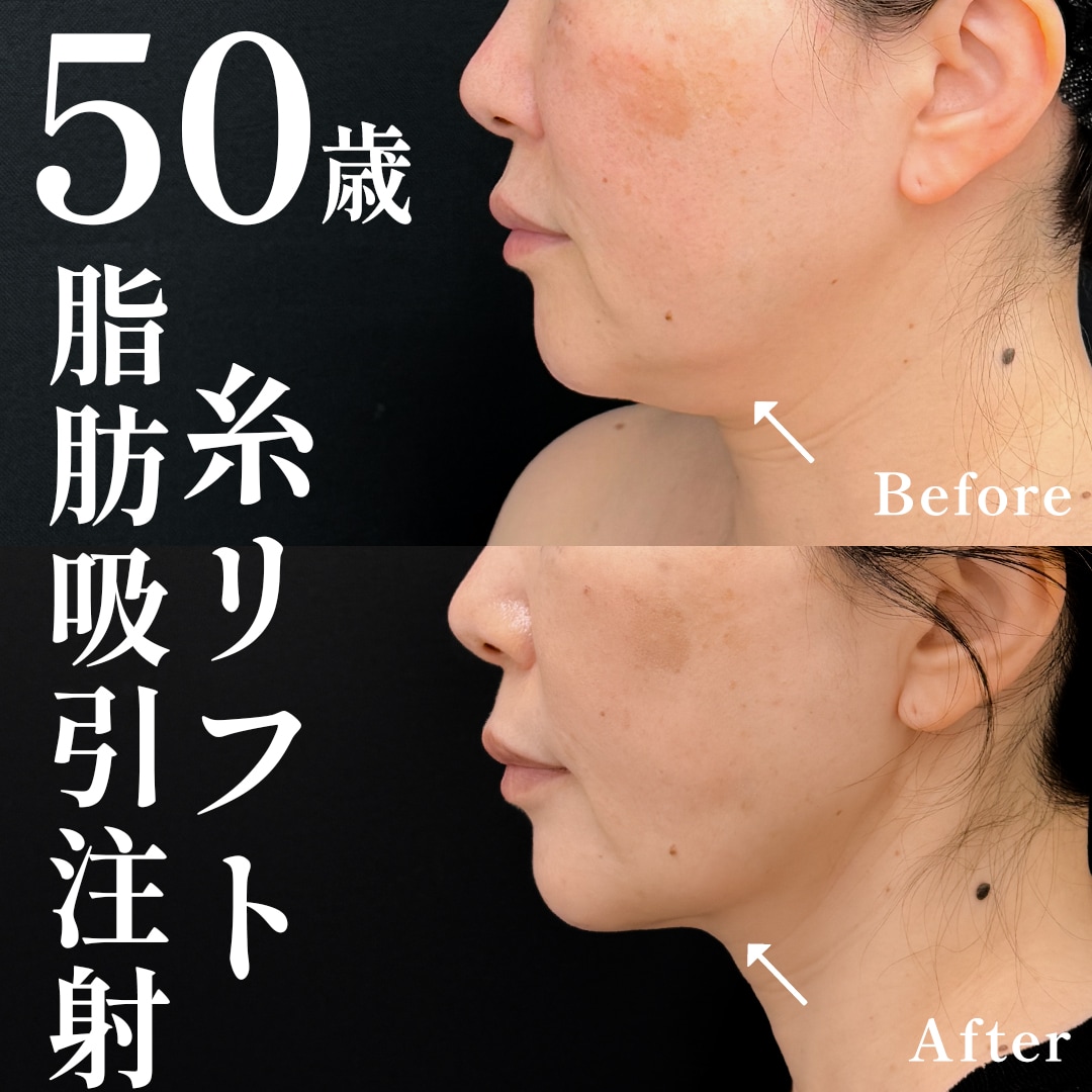 50代女性のモニター様