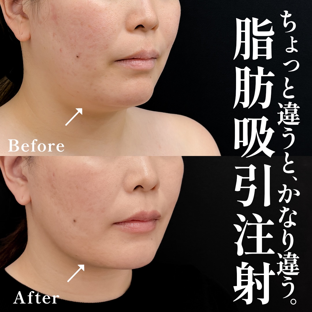 30代女性のモニター様