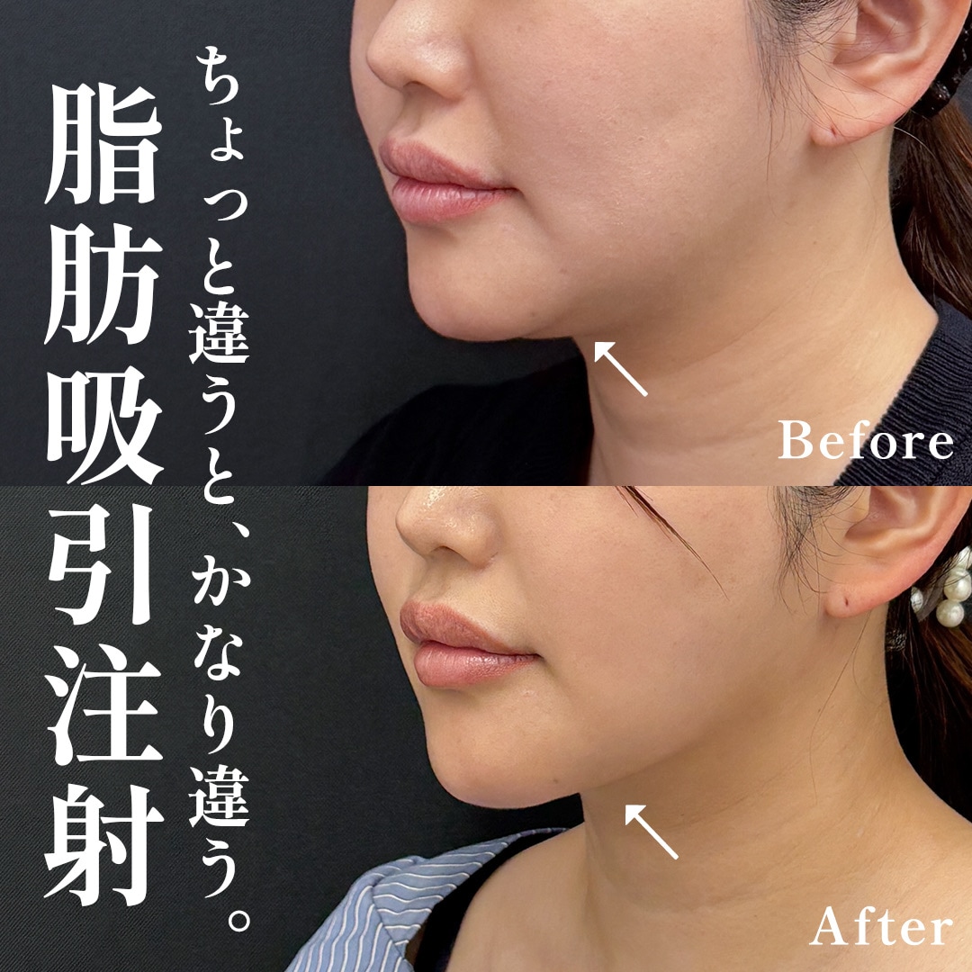 30代女性のモニター様