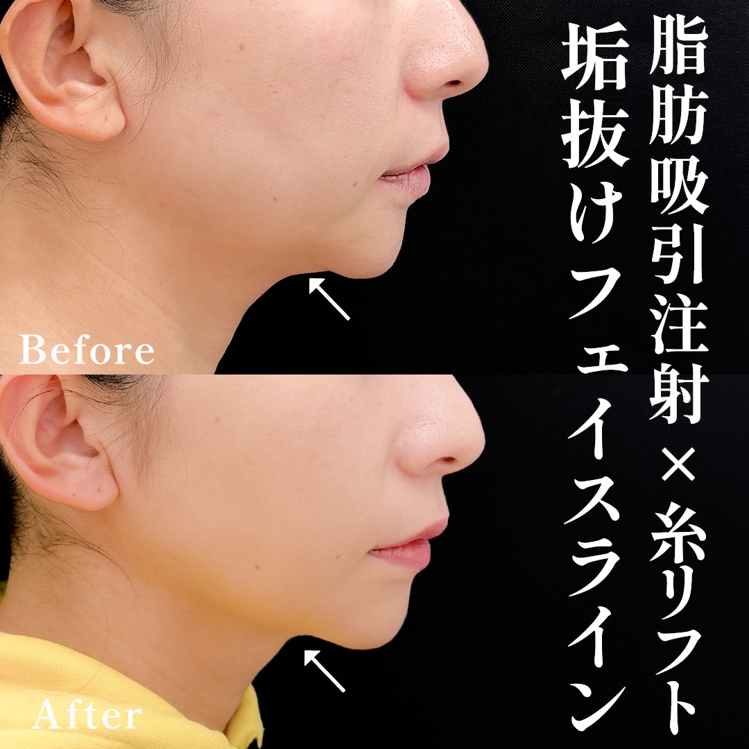 40代女性のモニター様