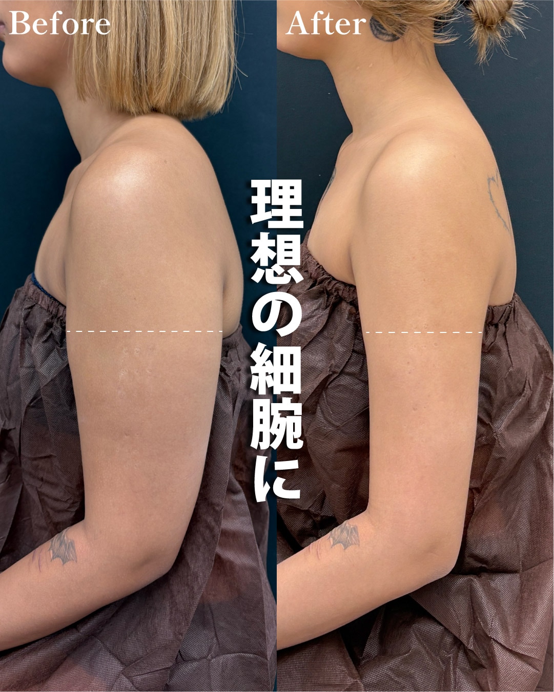 19歳のモニター様