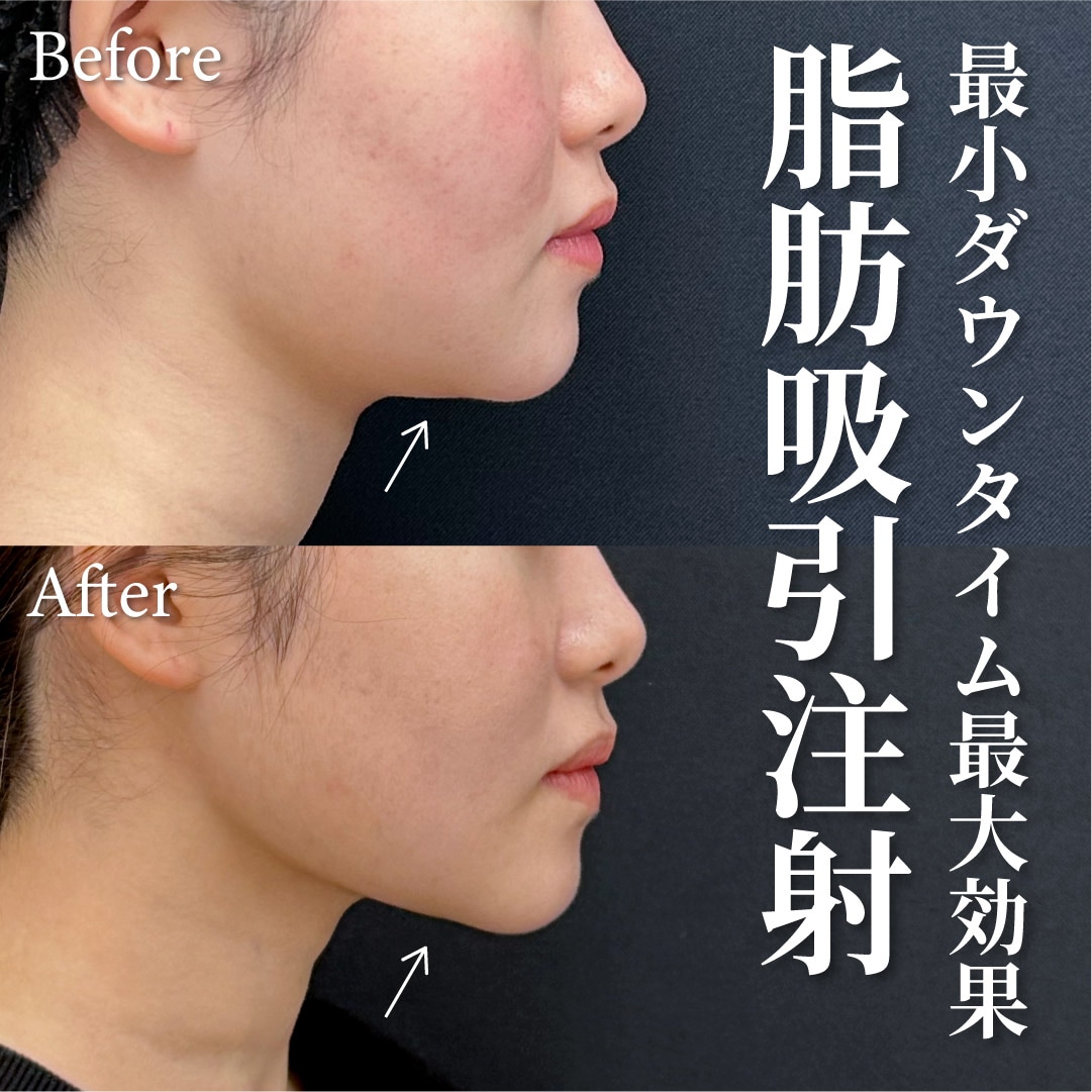 22歳女性のモニター様