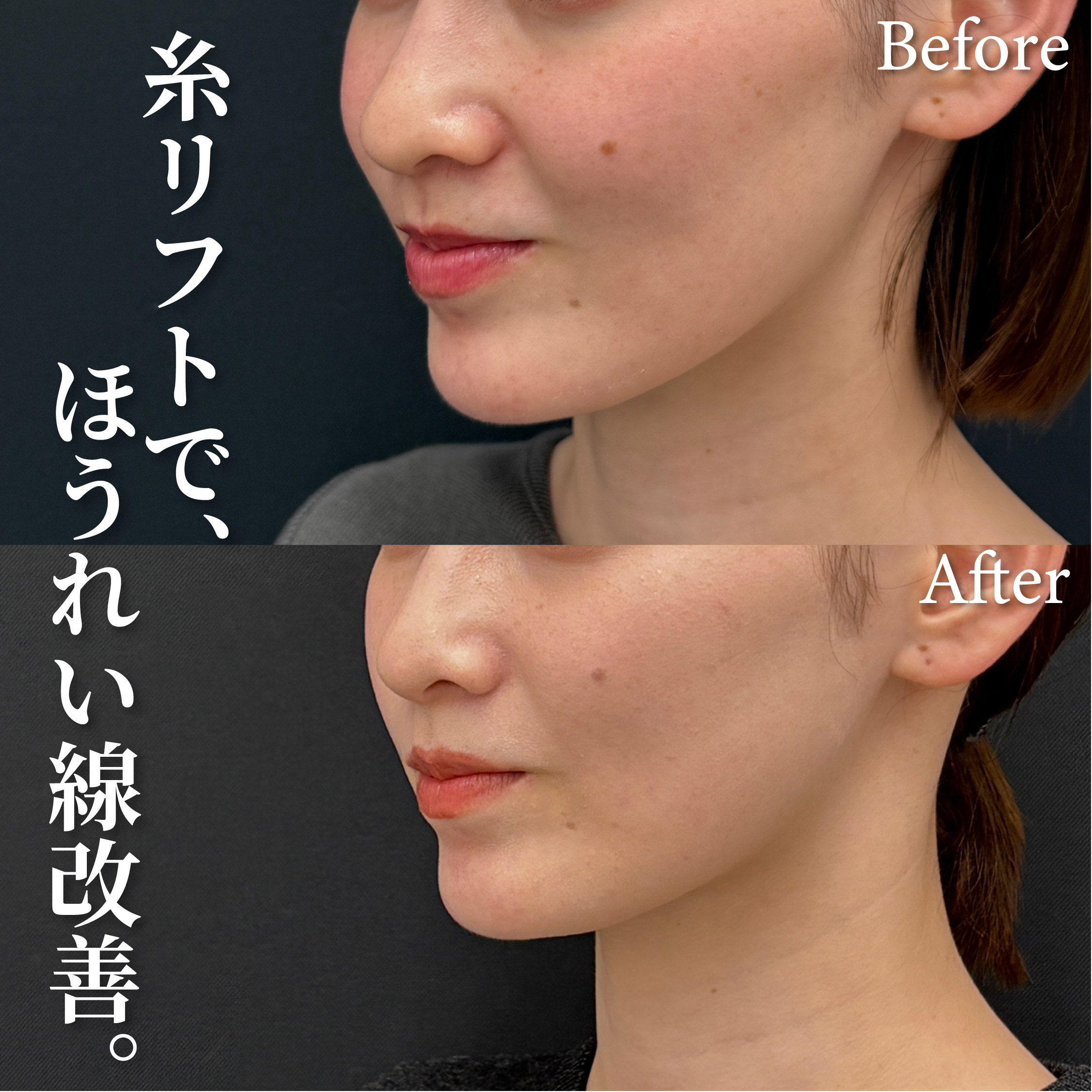 27歳女性のモニター様