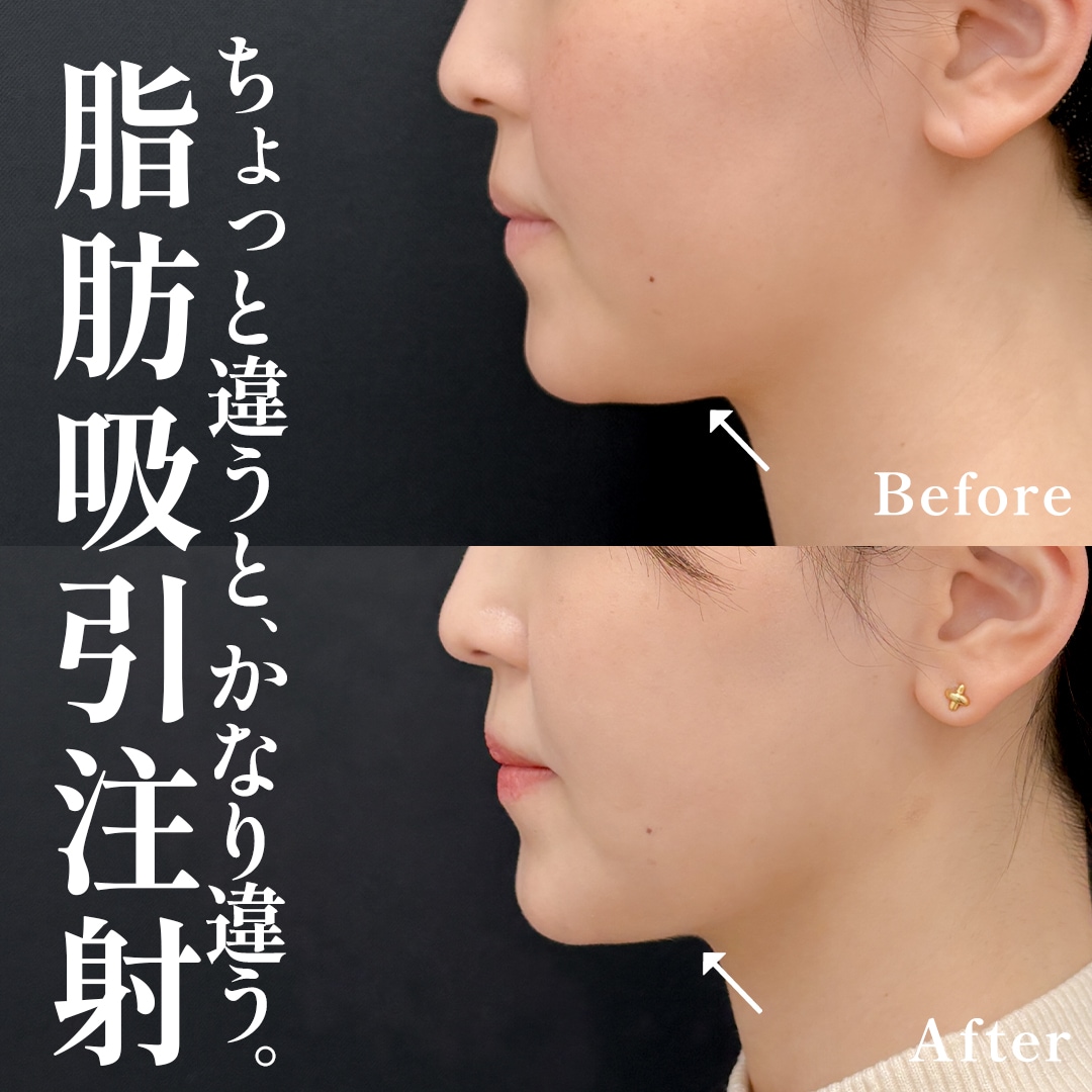 20代学生のモニター様