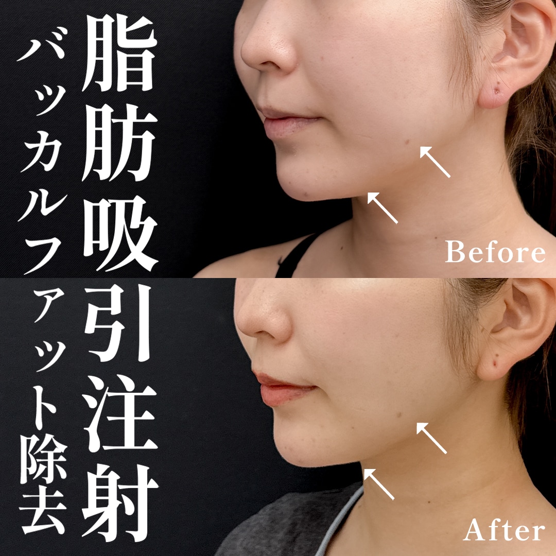 20代女性のモニター様