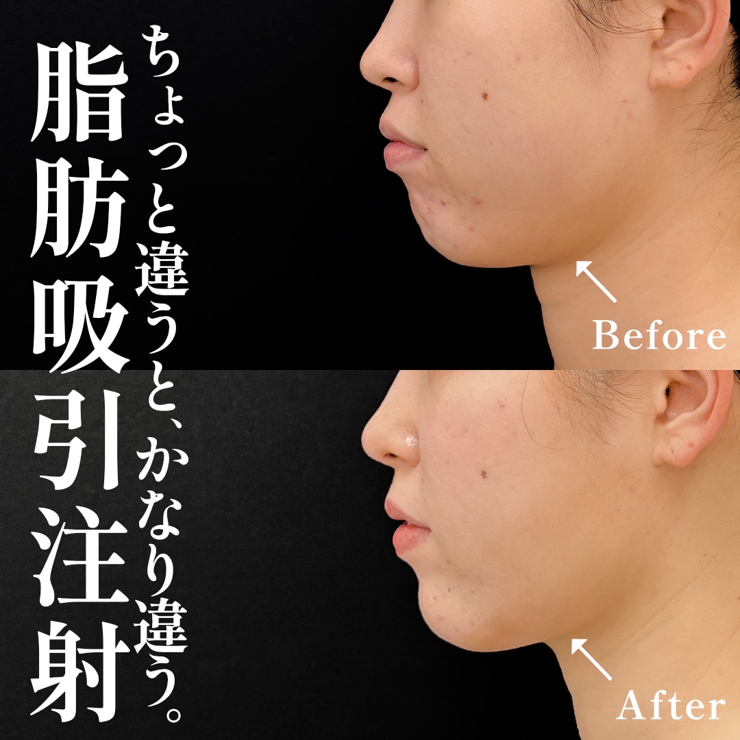 25代女性のモニター様