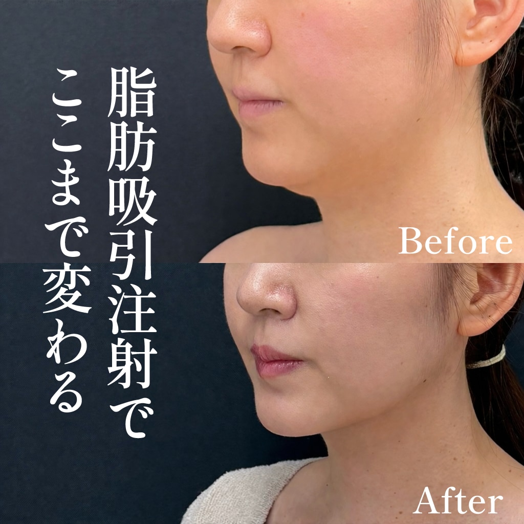 30代女性のモニター様