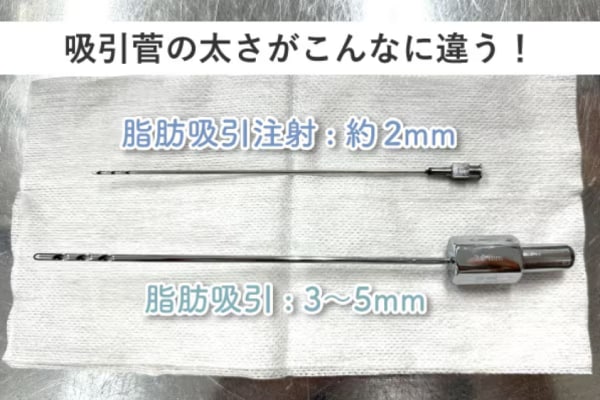 脂肪吸引注射とは