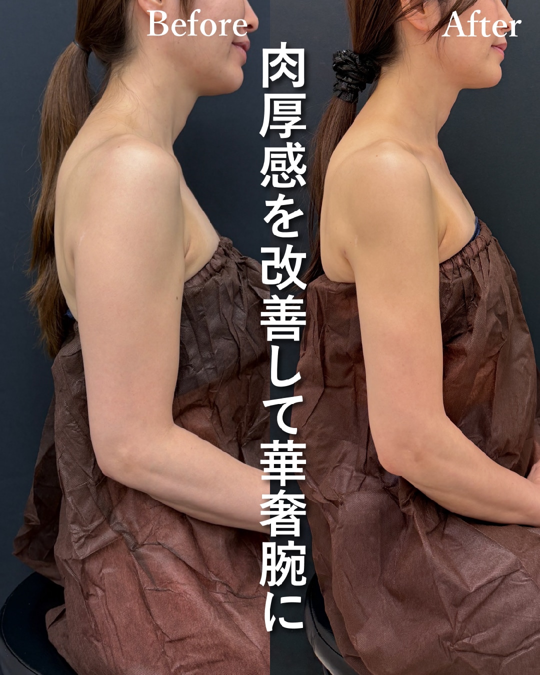 40代のモニター様