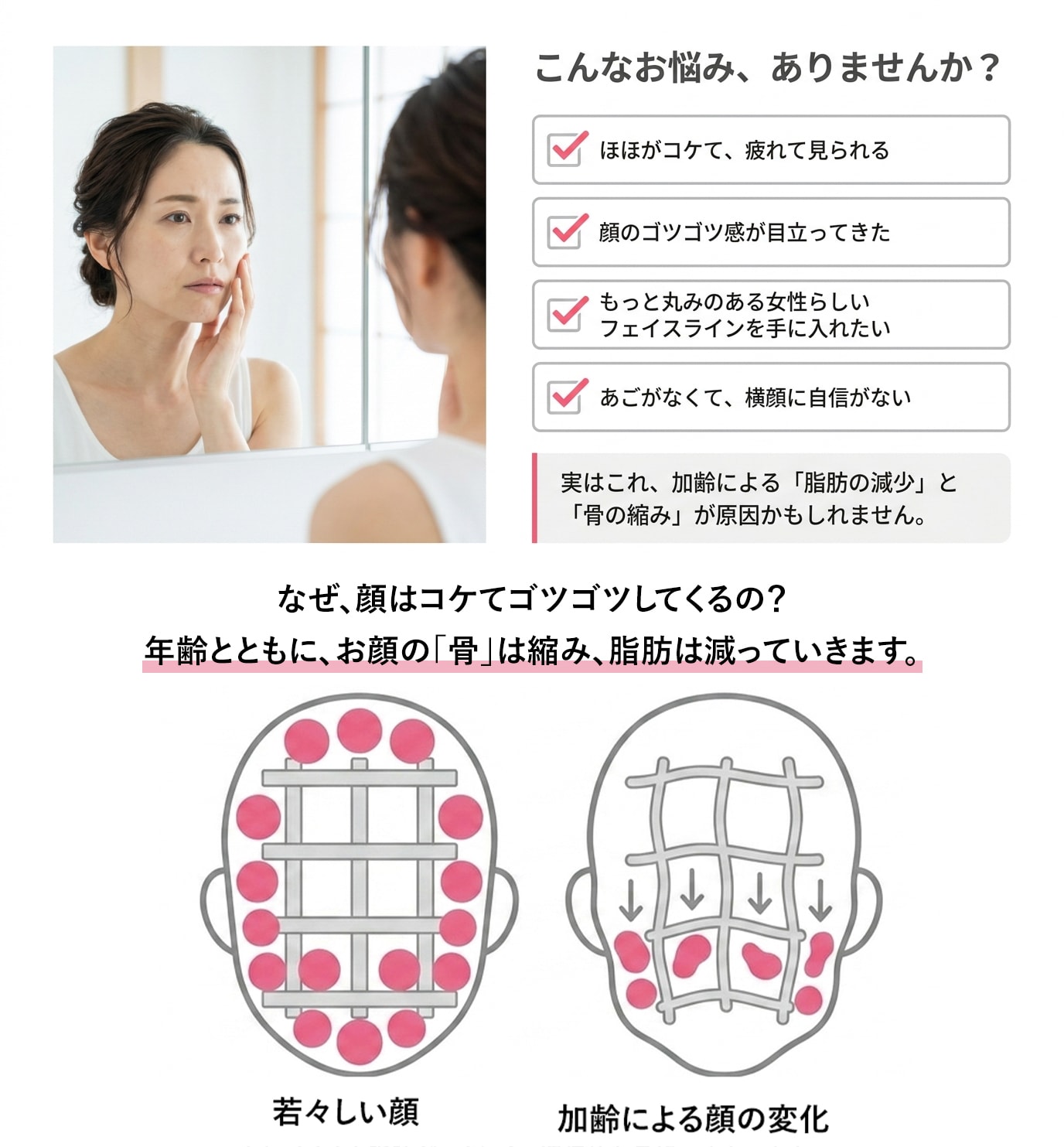 なぜゴツゴツ・老け見えしてくるの？