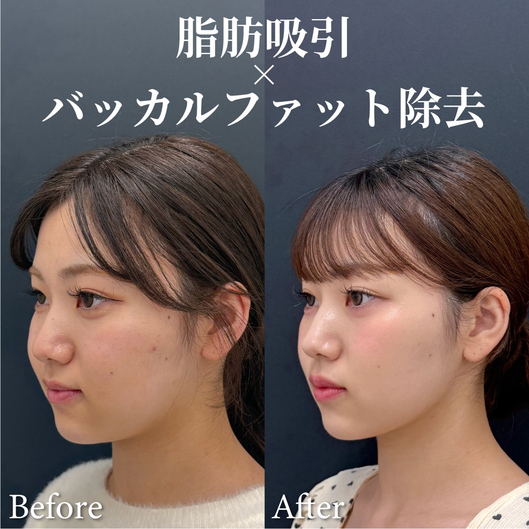 SNSの「奇跡の一枚」に騙されないで！ここをチェックしよう