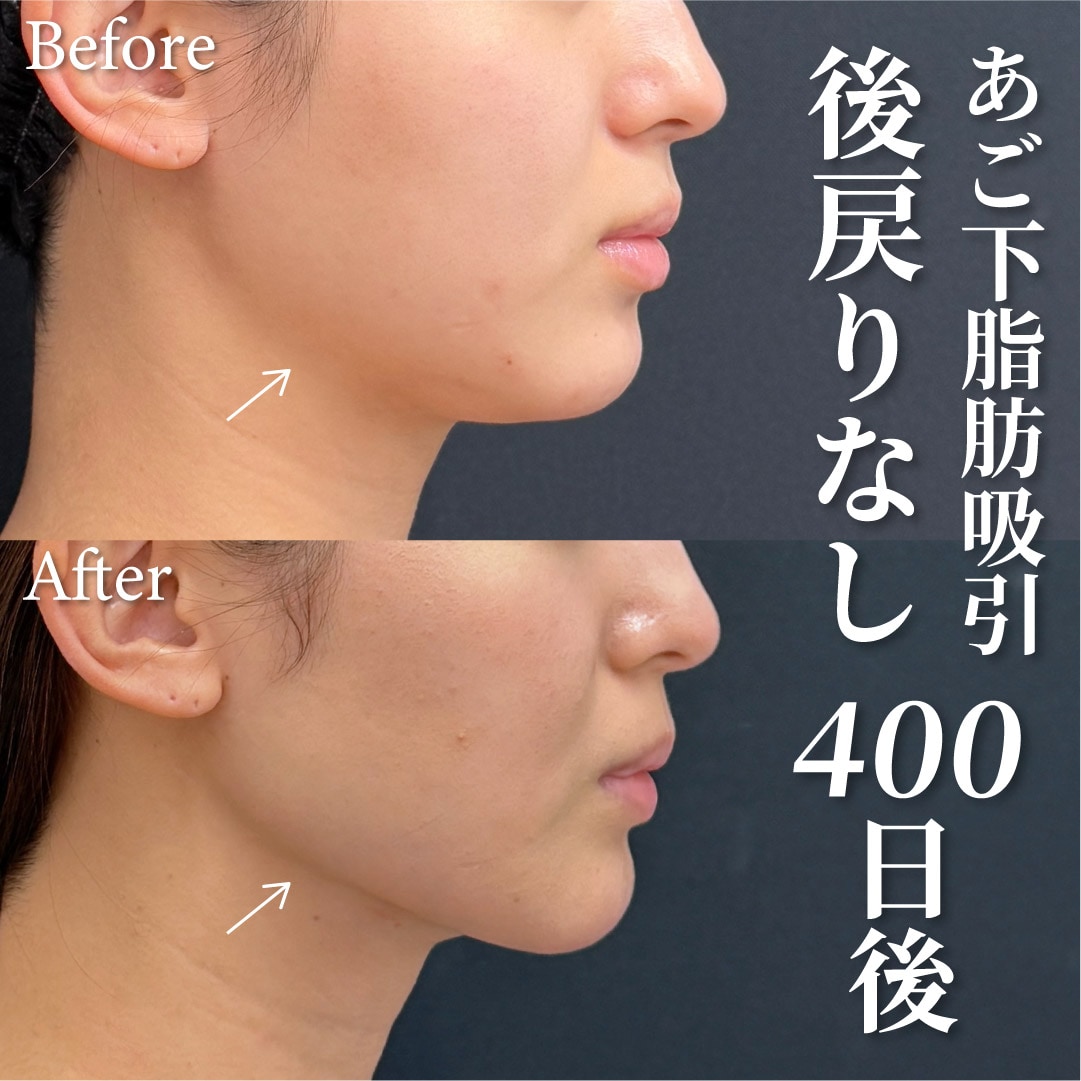 20代女性のモニター様