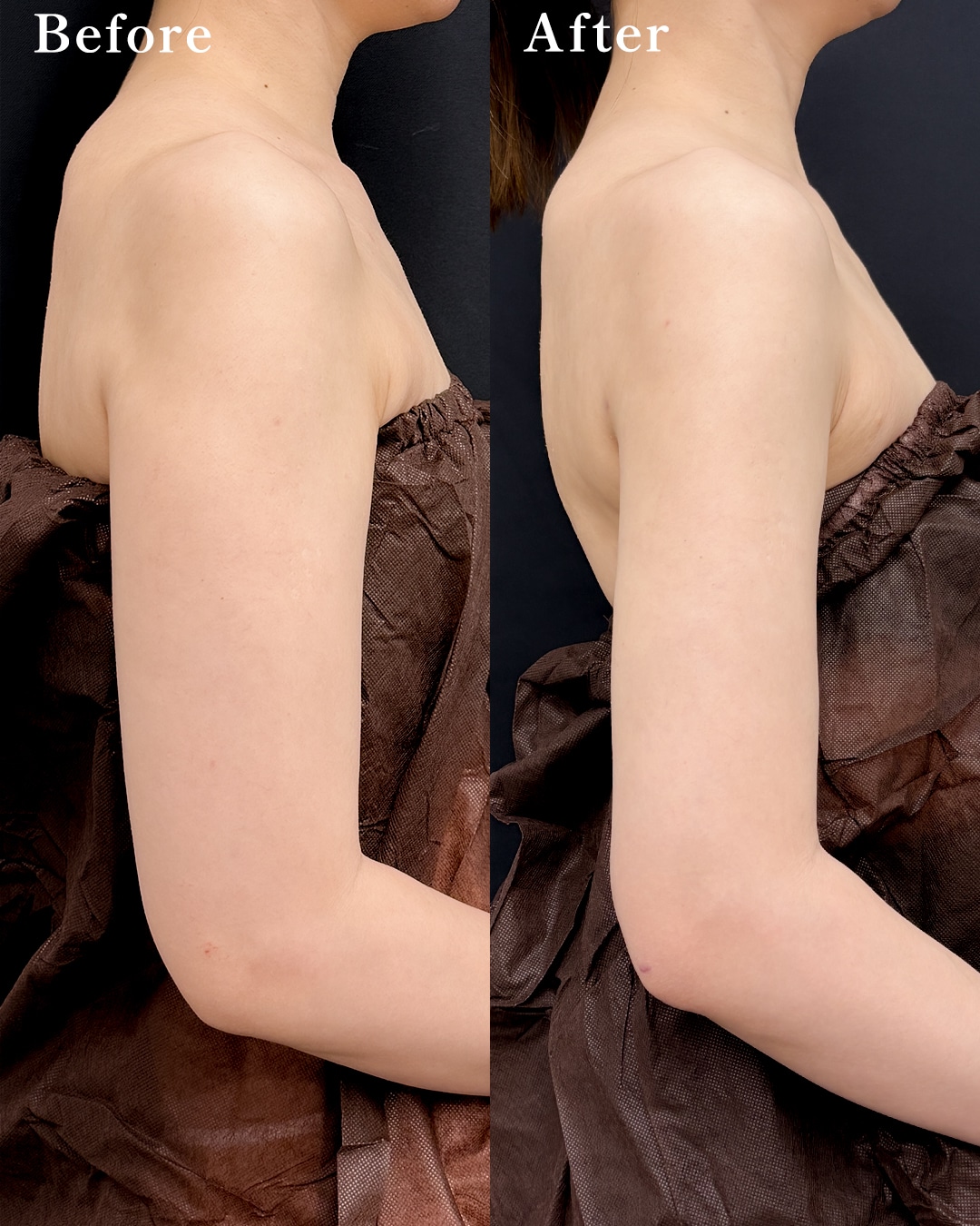 32歳のモニター様