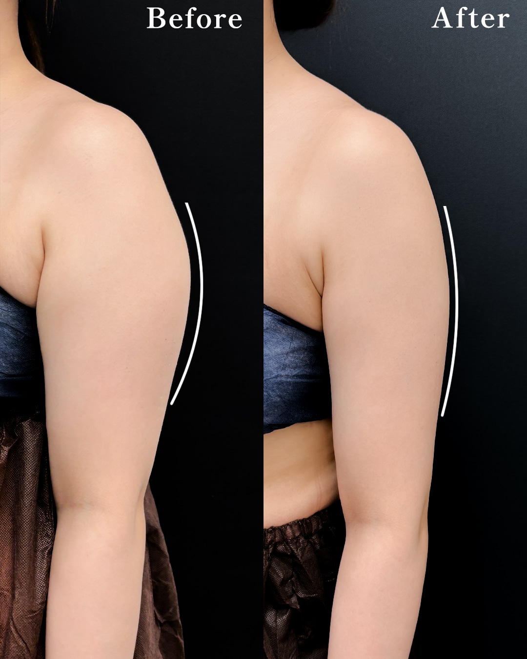 ３０代のモニター様