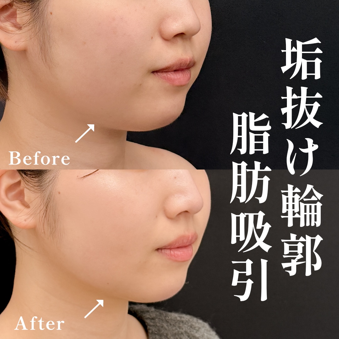 30代女性のモニター様