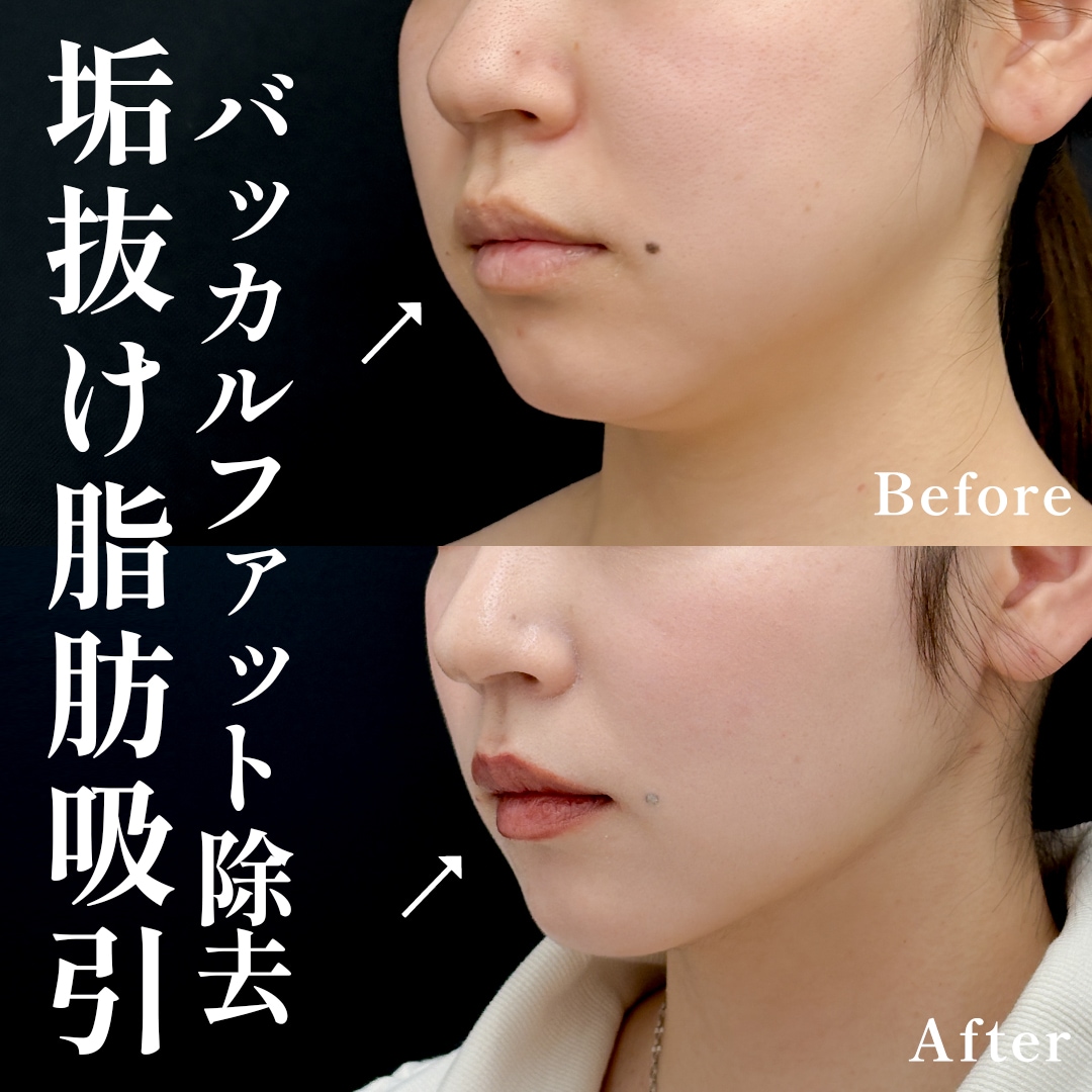 20代女性のモニター様