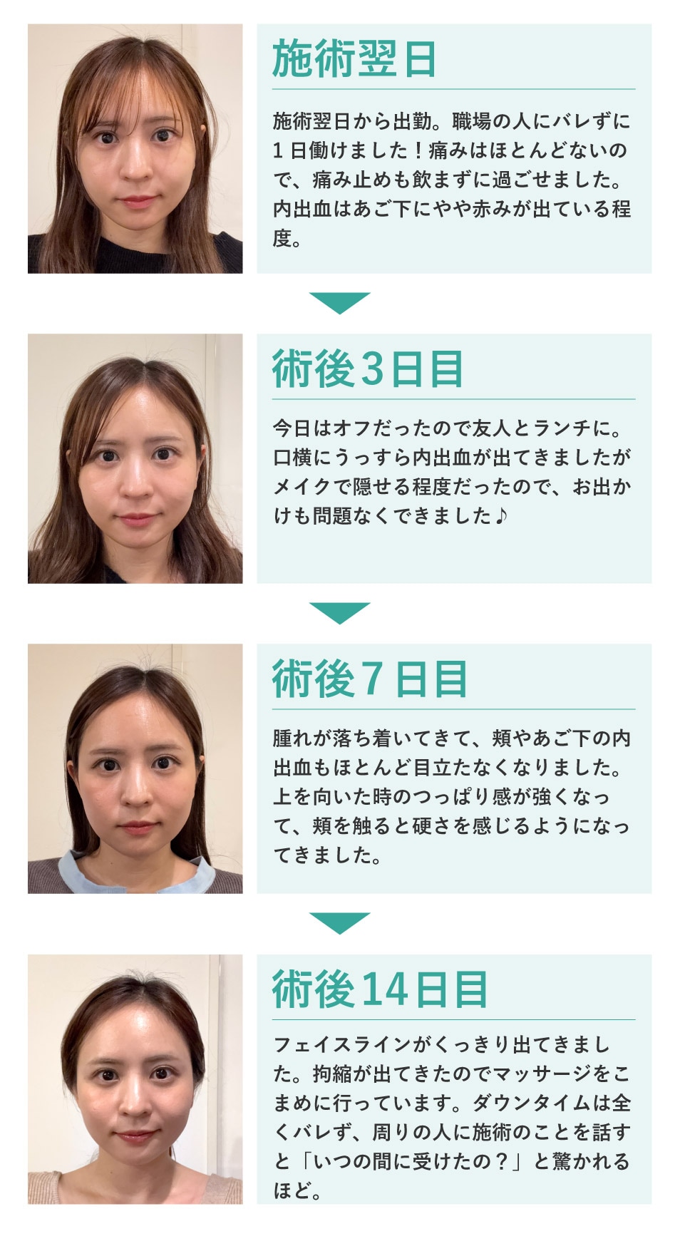 腫れ・内出血最小限でバレにくい！