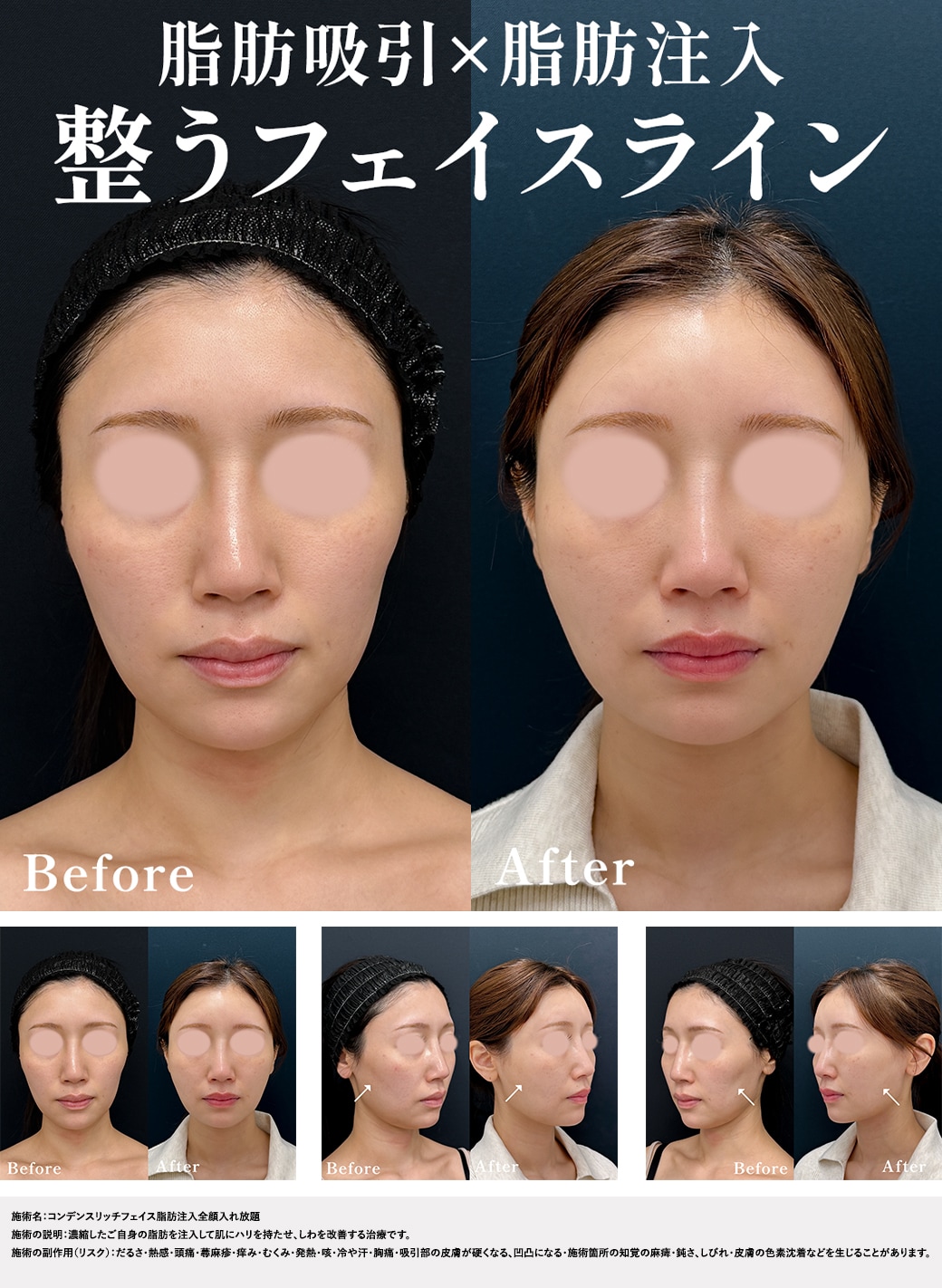 SNSの「奇跡の一枚」に騙されないで！ここをチェックしよう