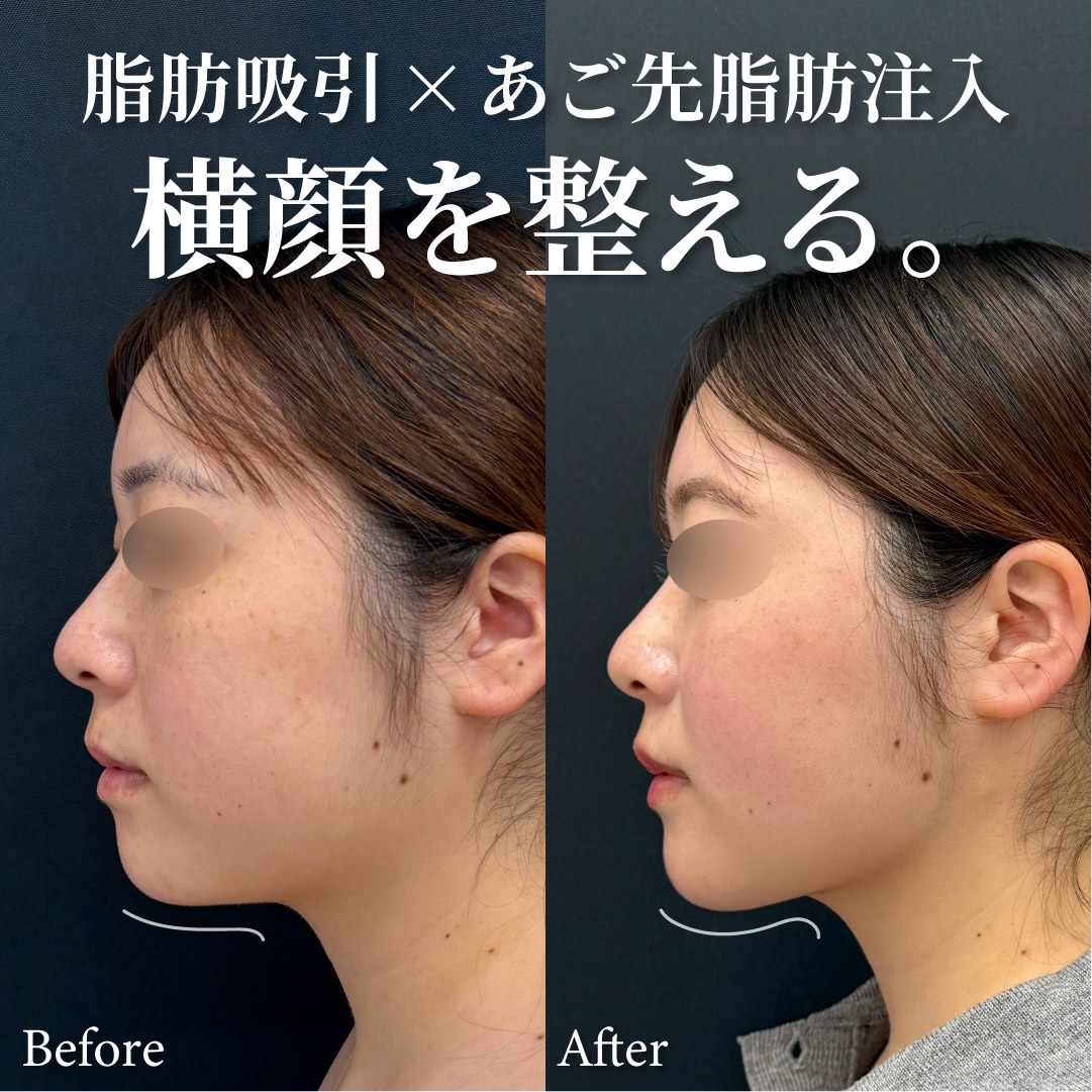 28歳女性のモニター様